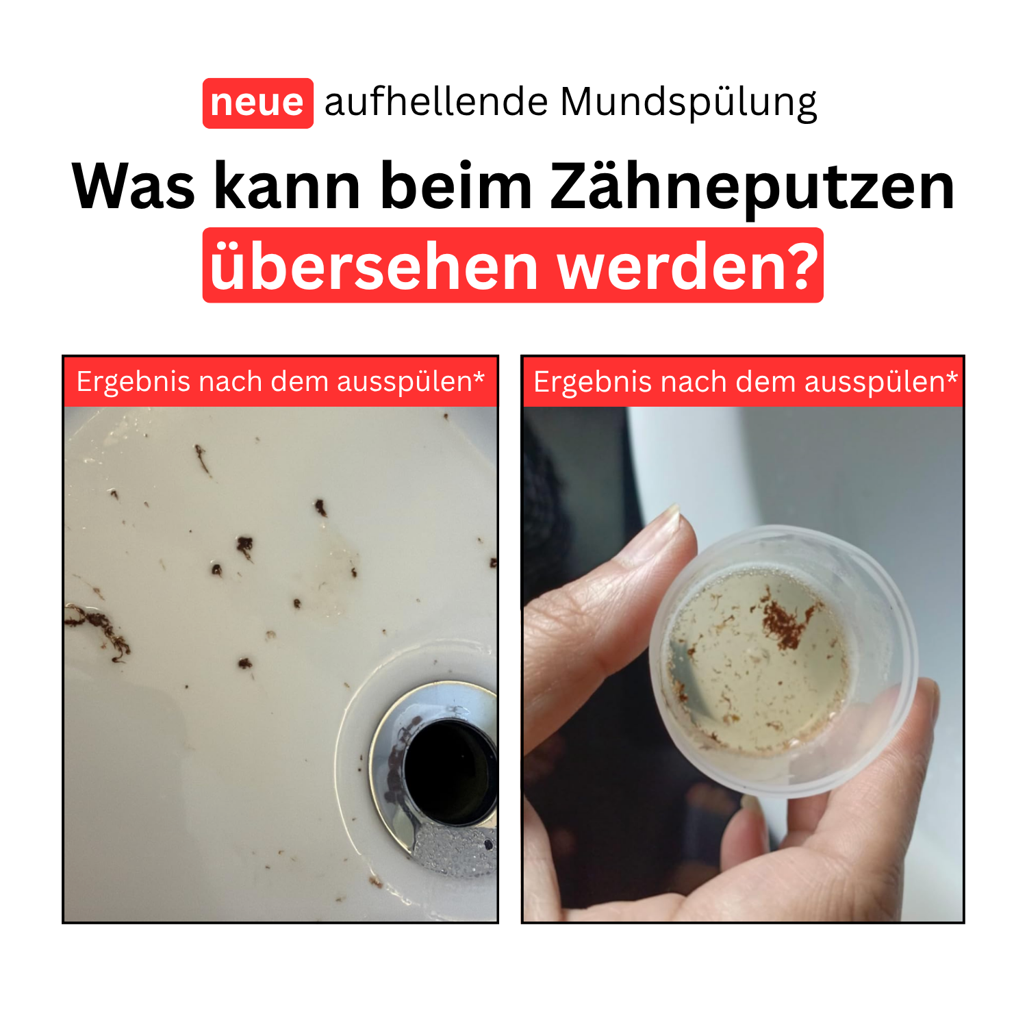 iD Mundspülung gegen Zahnverfärbungen