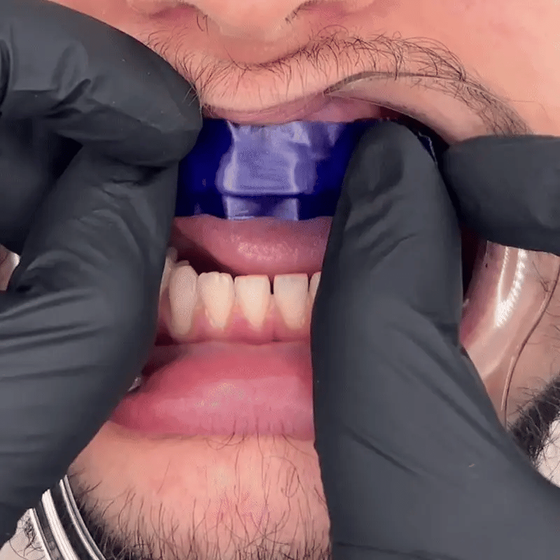 258C Farbkorrektur Bundle