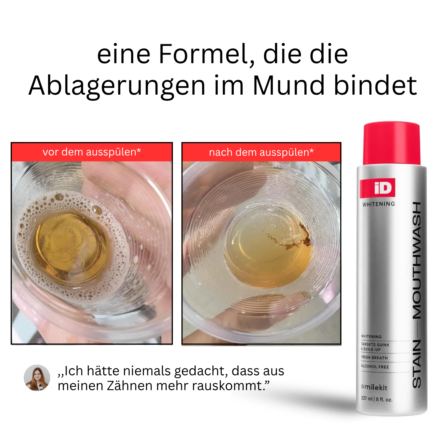 iD Mundspülung gegen Zahnverfärbungen