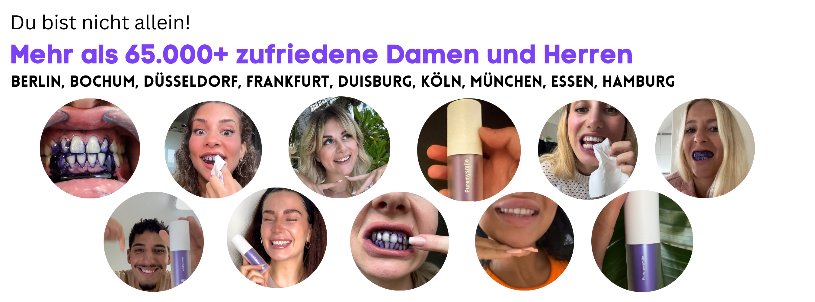 Bilder von Kunden und/oder deren Ergebnisse mit den Produkten von Puremysmile als Collage.