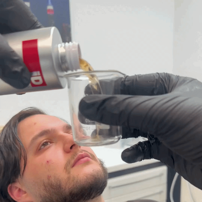 iD Mundspülung gegen Zahnverfärbungen